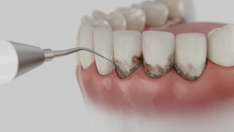 Reliable Dental Implants contractor in David City, NE by Smile Center Dentistry